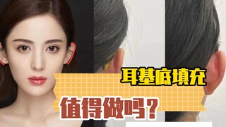 Apakah layak melakukan pengisian dasar telinga?