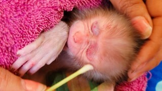 Most Care!! Mom cleans some wounded on little adorable Luca's face with the serum