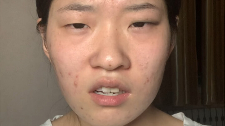 What exactly is a true puffy-eye look? This video will explain it all to you!