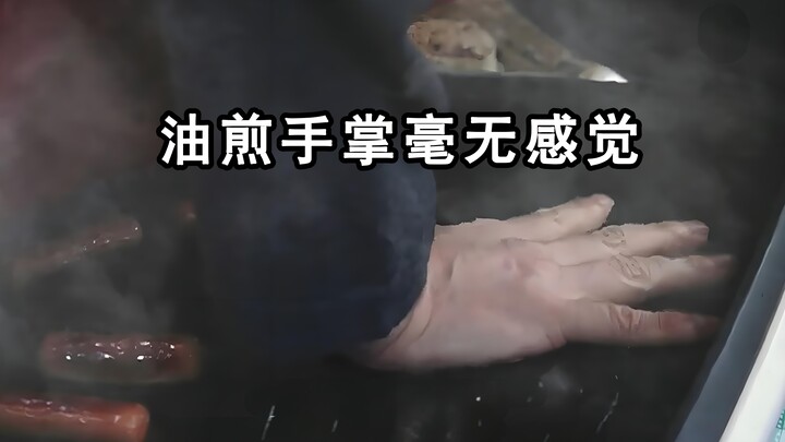 Woman Accidentally Puts Her Hand in a Hot Oil Pot Yet Feels Nothing | Cold