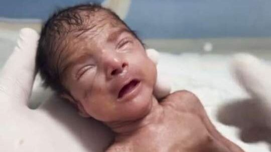 Newborn Daily Care Checkups