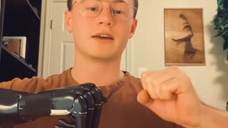 The guy with the robotic arm reveals the working principle of the bionic robotic arm. He was not def