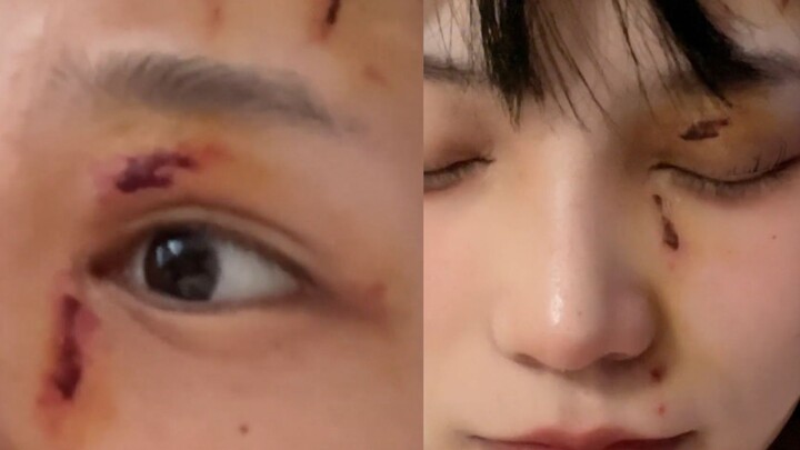 امرأة تتعرض للضرب المبرح على يد والدتها البيولوجية وتُكاد تُشوه وجهها، فسارع زوجها بسيارته لاصطحابها