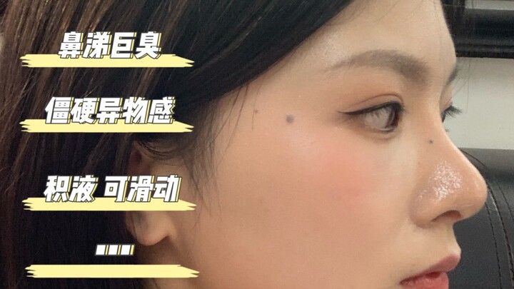 الإحساس العجيب بأنف غضروف الأذن: من الآن فصاعدًا، رائحة المخاط كريهة دائمًا!