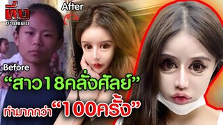 ตะลึง! สาววัย 18 คลั่งศัลย์ ทำมากกว่า 100 ครั้ง ในเวลา 5 ปี