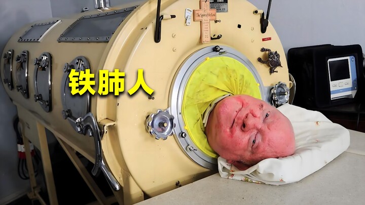 The Last Iron Lung Patient: Locked in an Iron Coffin at Age 6, He Lived There for 72 Years