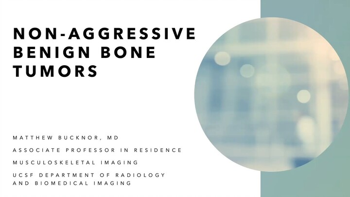 MSK Bucknor Bone Tumors