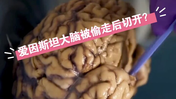 Einstein’s brain was sliced into thousands of pieces—and scientists really did find something differ