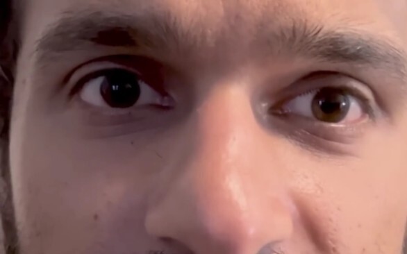 “Sỏi trong thận của bạn còn nhiều hơn cả cá trong bể cá ấy.”