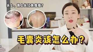 حبوب حمراء على الرأس والظهر؟ ماذا تفعل في حالة التهاب الجريبات؟