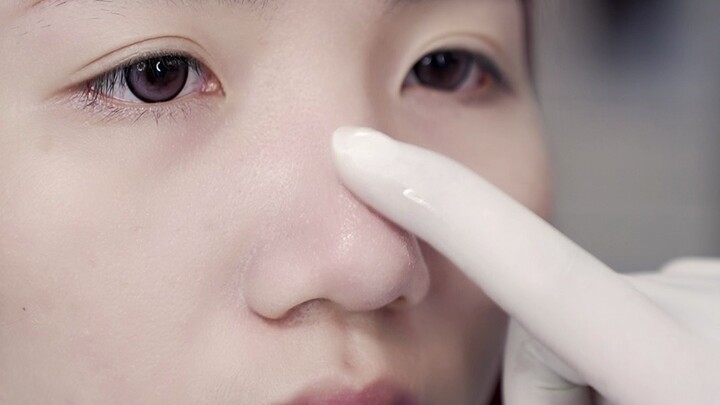 Jangan sembarangan dipencet! Benda-benda di wajahmu ini bukan jerawat, lho!?