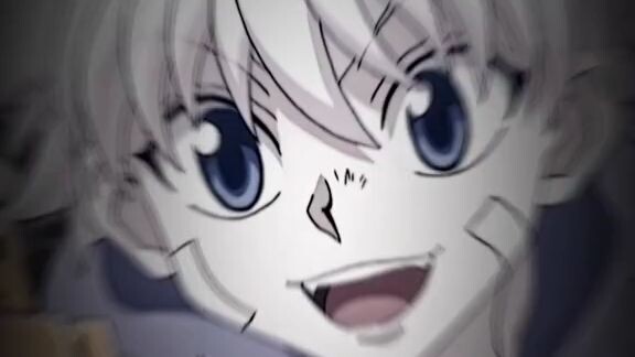 Killua zoldck