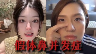 Tôi sẽ nói về những biến chứng của việc nâng mũi giả mà cơ sở không dám nói đến