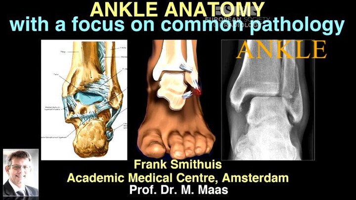 Ankle Anatomy with a Focus on Common Pathology