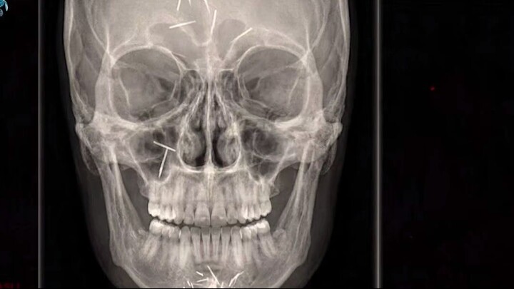Kisah Dokter muda lagi menangani kasus susuk guys, seru banget