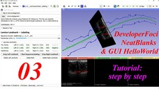 Developer _ Slicer Area, Neat Blanks, GUI HelloWorld -- 3D Slicer Extension Development Tutorial #03