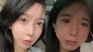 I had four wisdom teeth removed at once. Can you guys stop laughing?