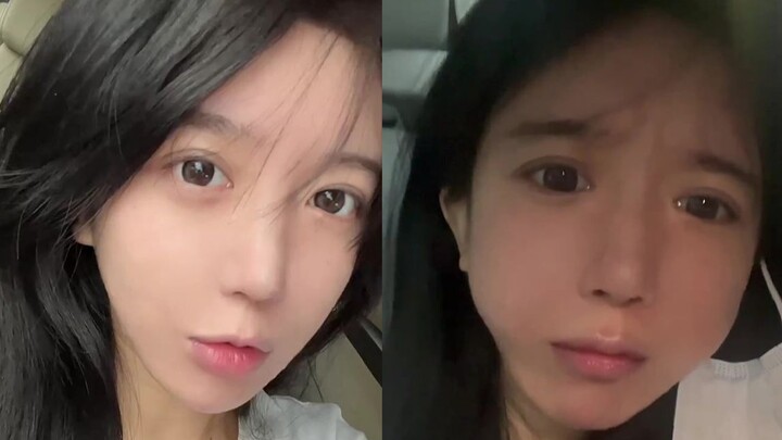 Tôi đã nhổ bốn cái răng khôn cùng lúc. Mọi người có thể ngừng cười được không?