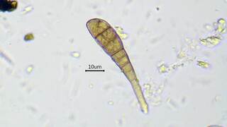 Growing of hyphae and septa formation in Alternaria sp. - fast time lapse