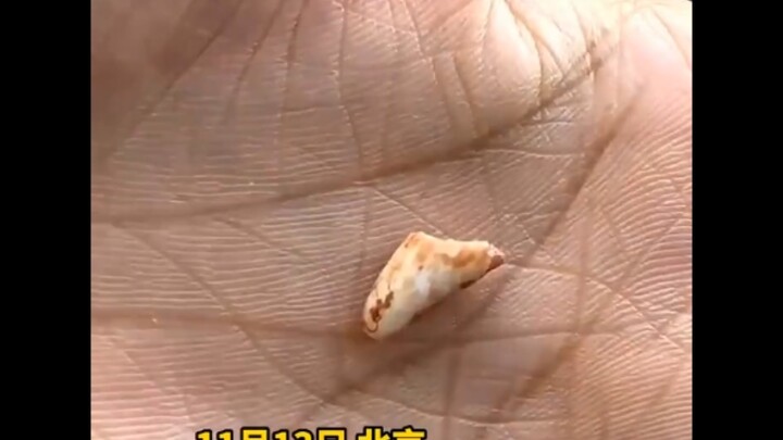 Guy Kicks Ball, Accidentally Hits Husky—and Loses a Whole Fang!