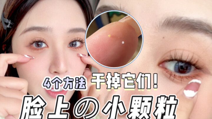 My milia suddenly disappeared?! A low-cost solution to get rid of those tiny bumps on your face!