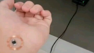 زرع بطاقة الطعام في الذراع.. التحويل الجسدي السيبراني نجح بنجاح!