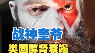 ตำนานเพาะกาย เครโตส ไตวาย และใช้สเตียรอยด์เกินขนาด ต้องเข้าห้องไอซียู