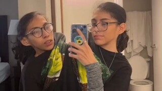 21岁的连体双胞胎姐妹，回答网友们关心的问题