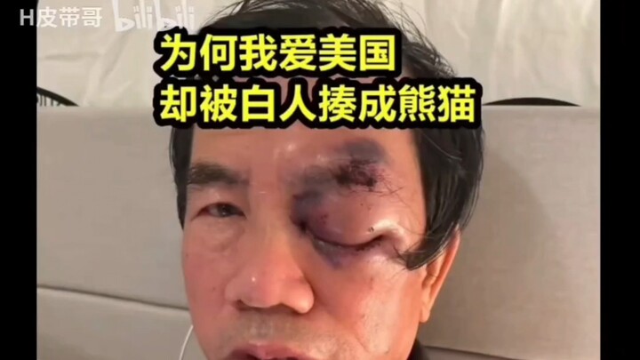 你爱美国美国爱你吗？你把自己当美国人，美国人把你当自己人吗？