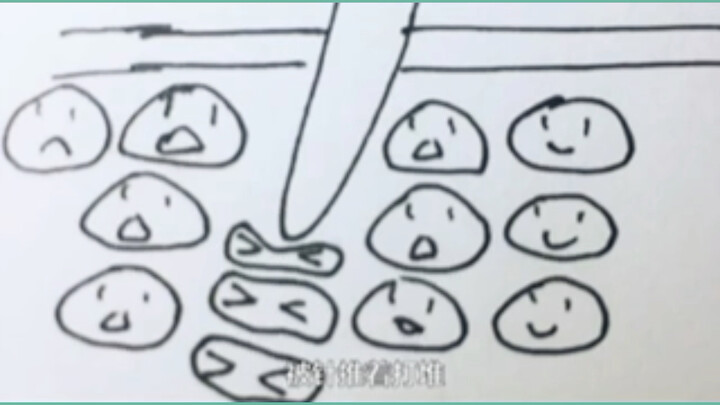 Kenapa saat menindik telinga, sepotong daging nggak ikut tertusuk keluar?