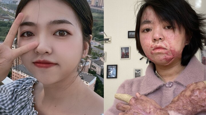 Growing up is as painful as unraveling silk from a cocoon.