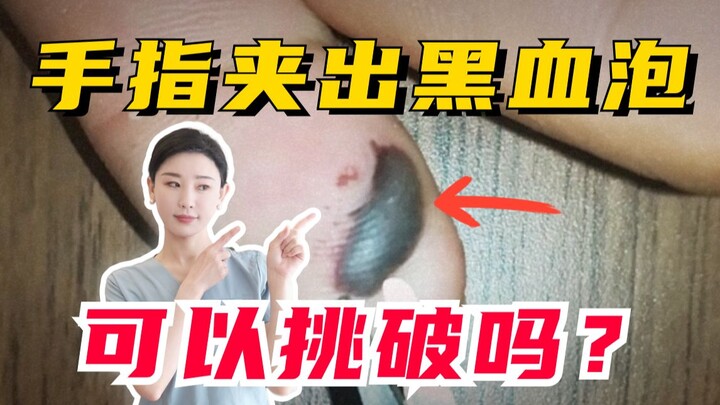 เผลอทำไปครั้งเดียวมันสะใจ ทำไปเรื่อยๆ ก็สะใจเรื่อยๆ