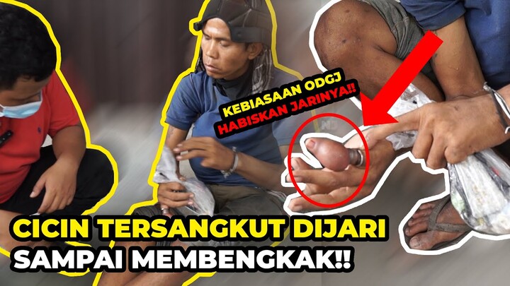BAHAYA JIKA DIBIARKAN!! JARI NYA TERSANGKUT CINCIN SAMPAI MEMBESAR | FIRUL TV