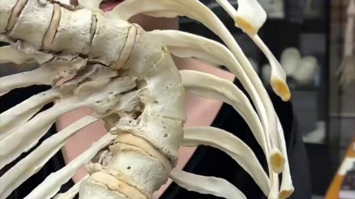 Di New York, ada sebuah museum yang mengoleksi berbagai “tulang manusia abnormal”.