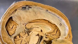 لا عجب أن "الأذن والأنف والحنجرة" تُصنّف في قسم واحد، فقد اتضح أنها مترابطة ومتأثرة ببعضها البعض