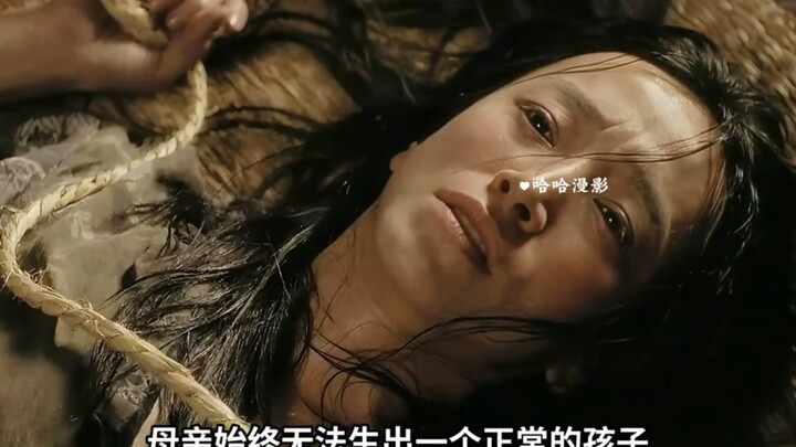 Due to inbreeding, they gave birth to a freak.