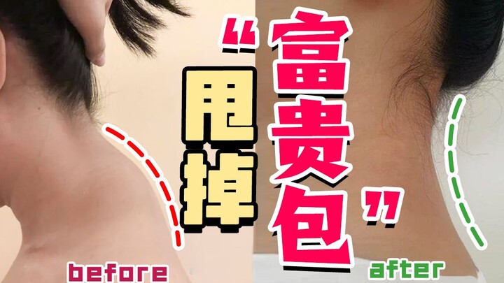 Nó được mệnh danh là “tư thế khiếm nhã” hàng đầu? Một bước giải quyết tình trạng đầu cổ đưa ra trước