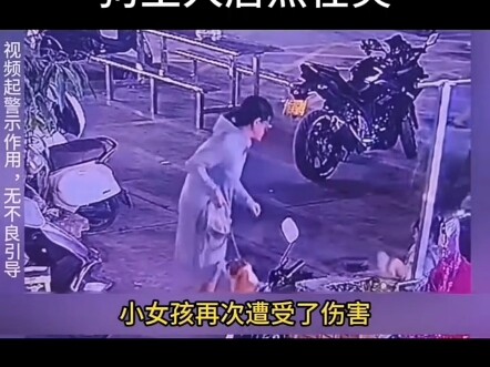 A girl was bitten twice by a vicious dog, and the dog owner was actually laughing heartily — pure po
