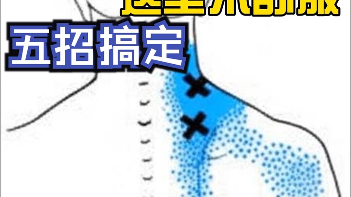 ปวดกล้ามเนื้อยกสะบัก (1)