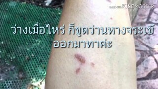 ว่านหางจระเข้/ปลูกดีมีประโยชน์ ได้ใช้ยามฉุกเฉิน