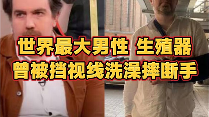 Người sở hữu cơ quan sinh dục nam lớn nhất thế giới từng bị cản tầm nhìn khi tắm vì quá lớn, dẫn đến