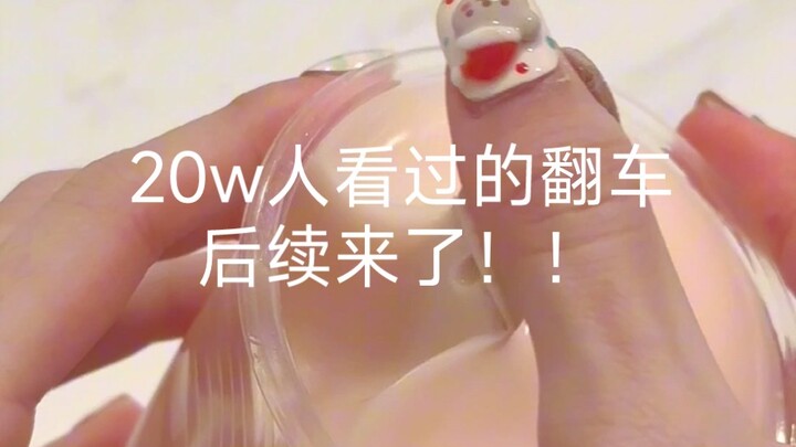 ผลลัพธ์หลังจากถอดแม่พิมพ์นีดเดิลฟันรถ