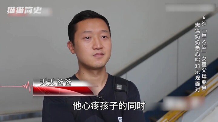 6-Year-Old Girl Develops Gigantism: Grows 15 cm in Just Four Months—Doctors Warn It’s Extremely Dang