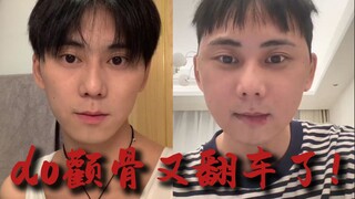 do颧骨又翻车了！！！