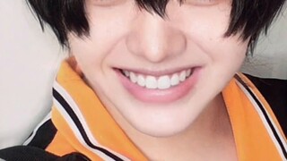 Chẳng phải hiệu ứng đặc biệt này thực sự được thiết kế để cosplay biểu tượng cảm xúc của Tobio Kagey
