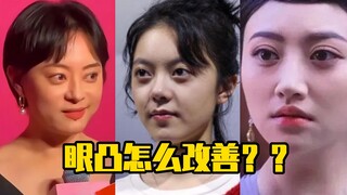 Bagaimana cara memperbaiki mata yang menonjol?