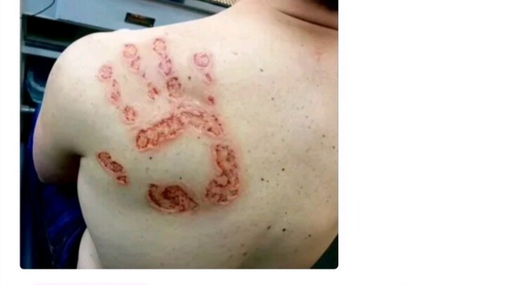 Silly Genius Comment: Does anyone still remember that palm technique that seemed to fall from the sk