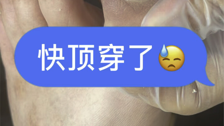 สุดยอดความเปรี้ยวสดชื่น