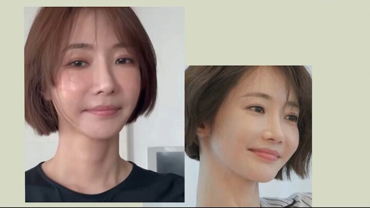 短缩颌矫正，何时开始最好？