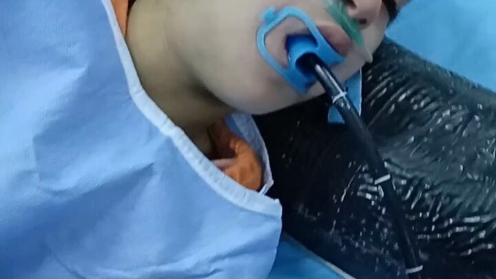 Girl accidentally swallows a coin; emergency endoscopic removal performed under general anesthesia.